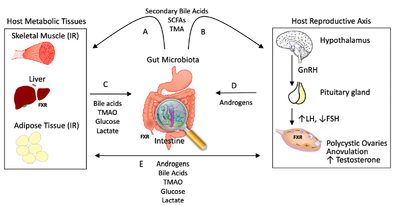 Relationship between the gut microbiome and PCOS